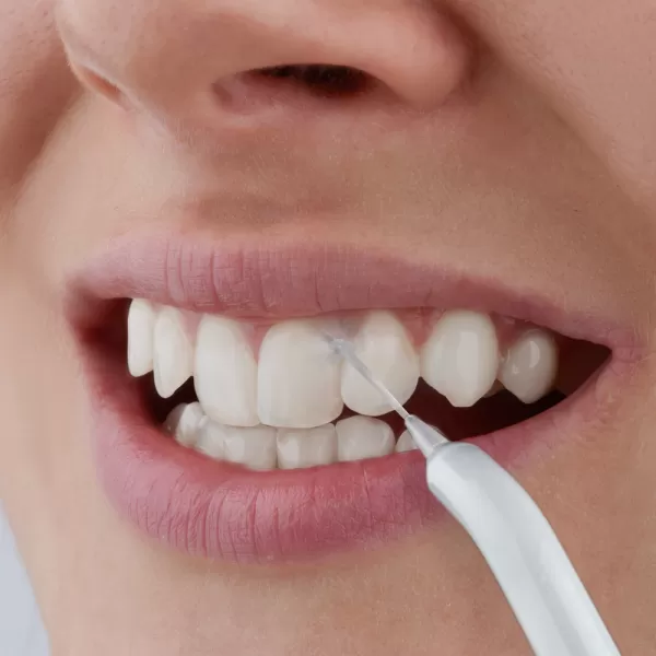 SOI 2200SL ÚSTNÍ SPRCHA SENCOR